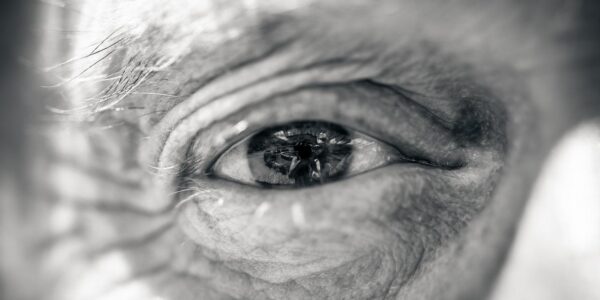 Catarata: cientistas criam remédio que pode substituir cirurgia nos olhos