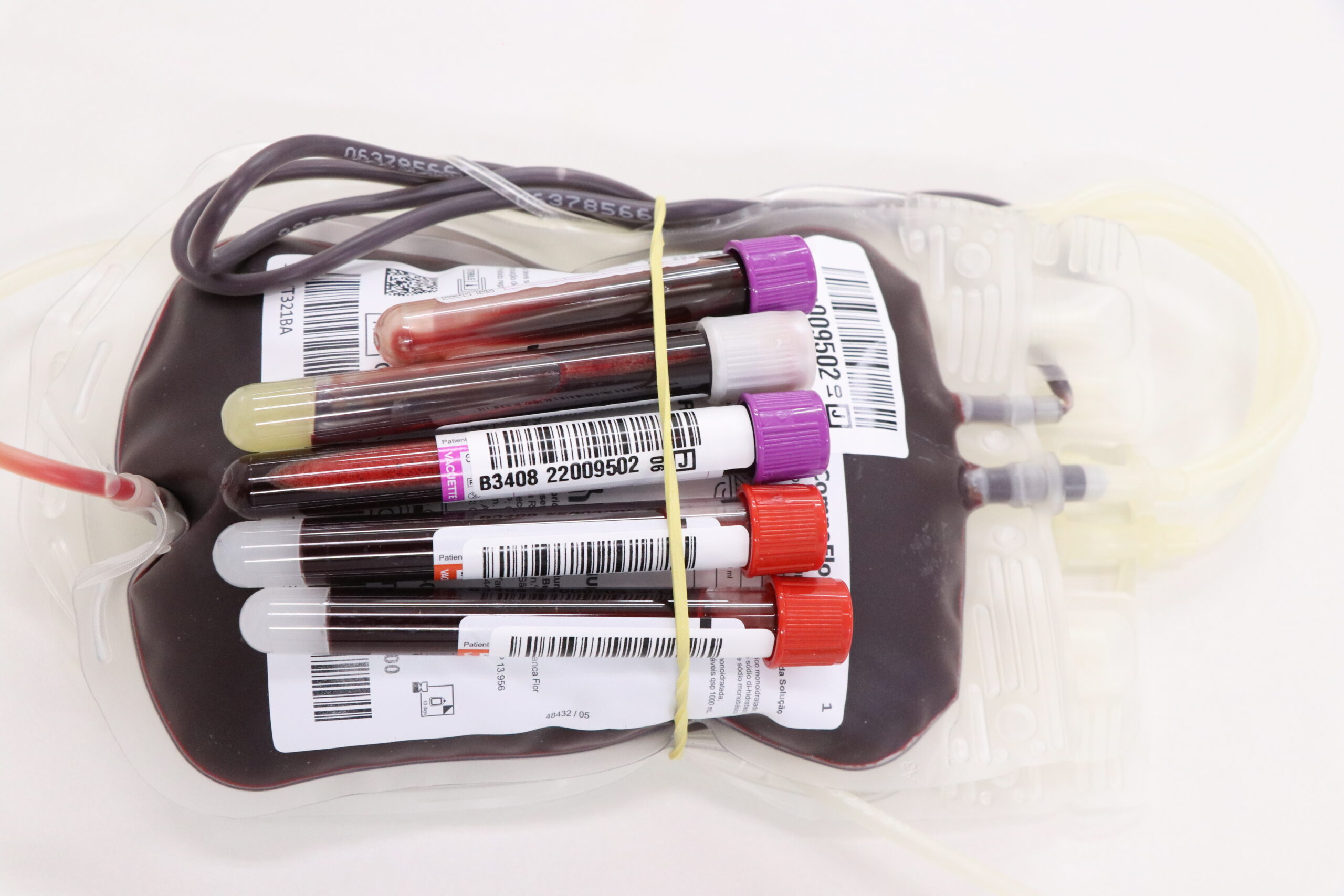 Pró-Sangue disponibiliza posto de Carapicuíba para doadores