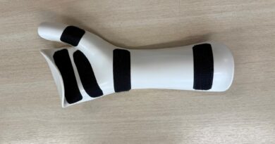 Em Barueri, SDPD confecciona e entrega órteses sob medida