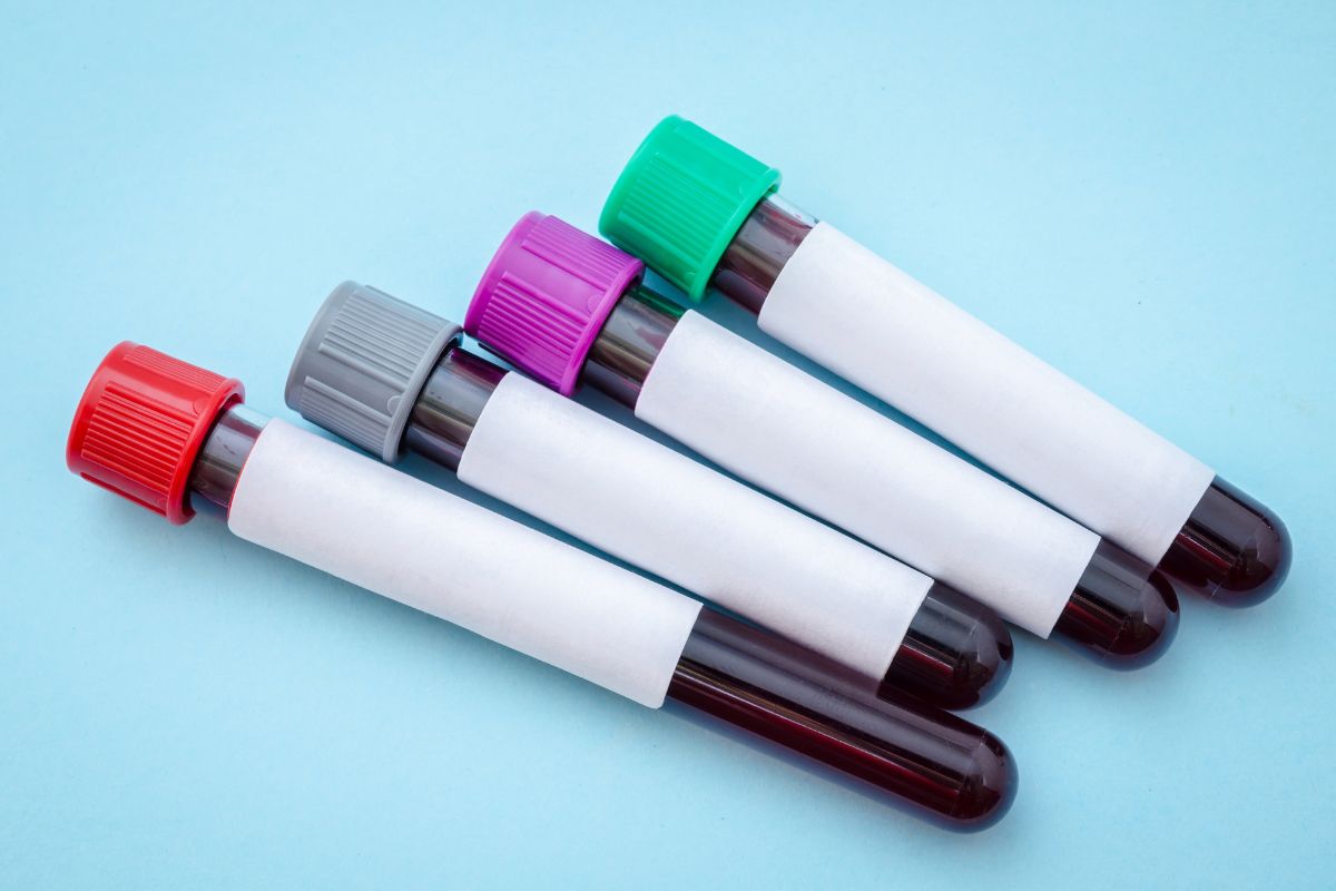 Exame de sangue para Alzheimer chega ao Brasil por R$ 3 mil
