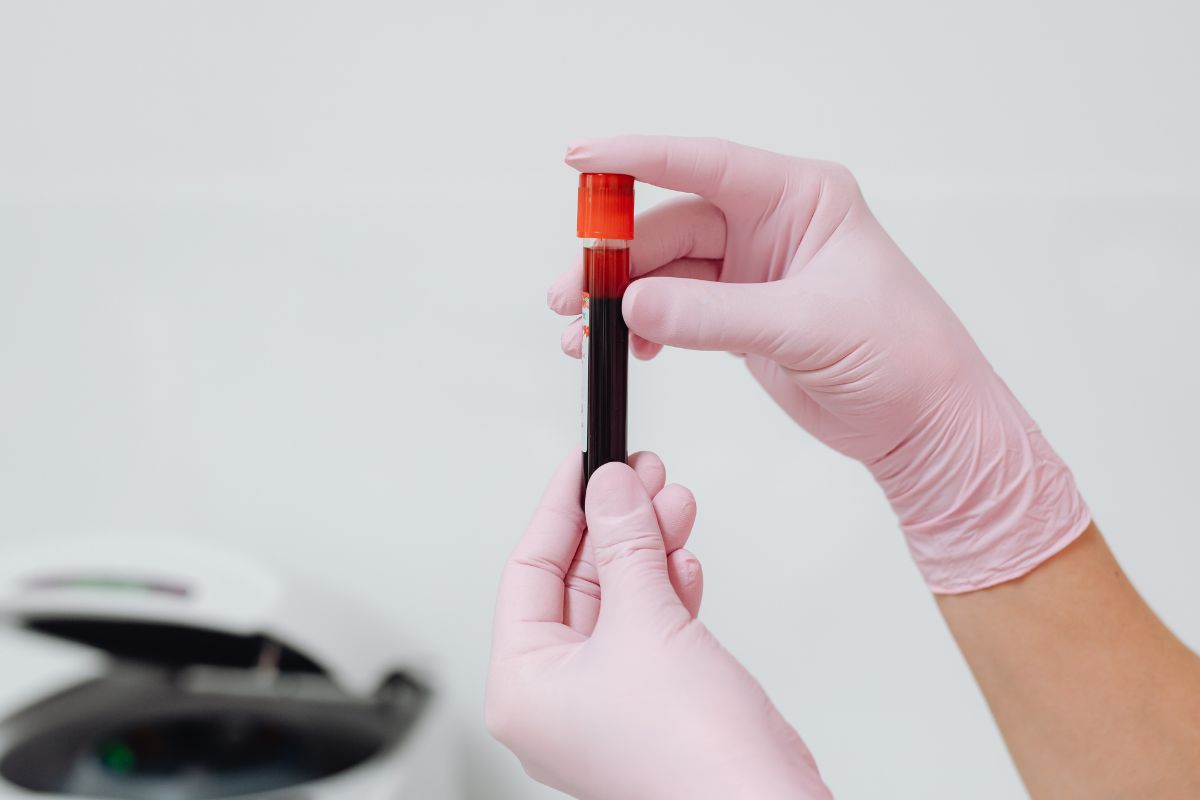 Exame de sangue para Alzheimer chega ao Brasil por R$ 3 mil