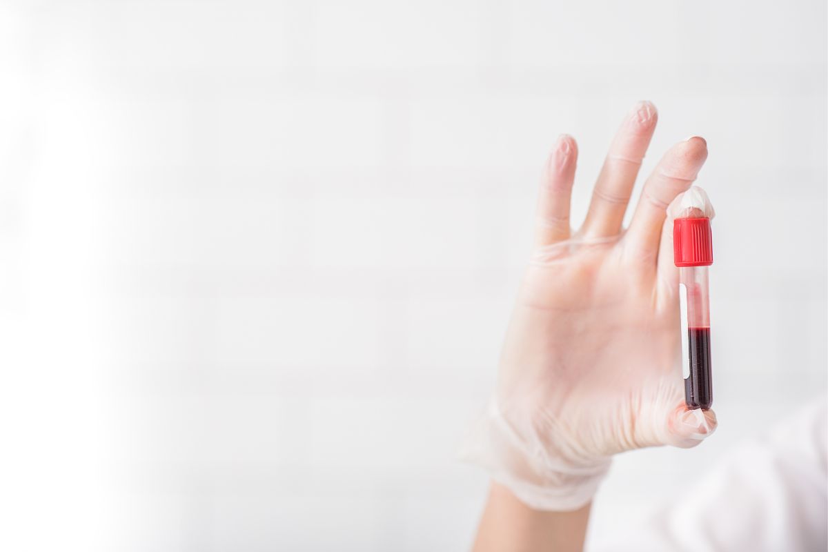 Exame de sangue para Alzheimer chega ao Brasil por R$ 3 mil